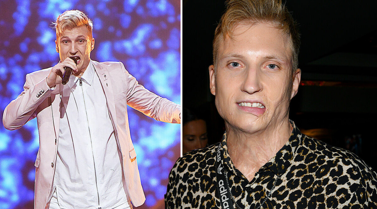 Allt om Axel Schylström – flickvännen, barn, olyckan och brännskadan