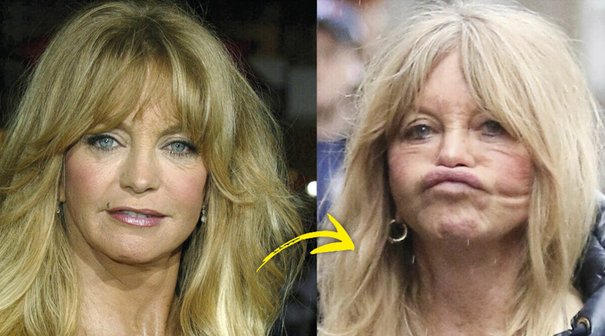 Goldie Hawn oigenkännlig: ”Börjar se ut som en vaxdocka”