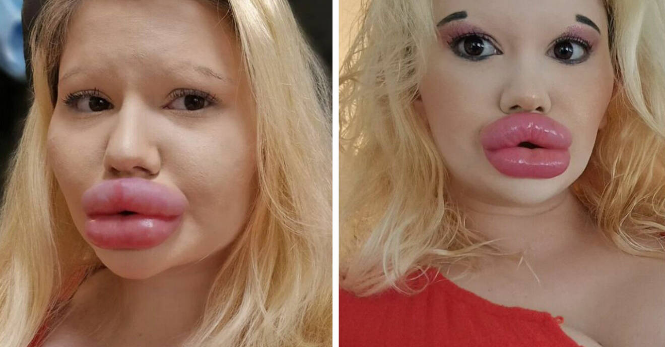 Andrea, 25, med världens största läppar söker pojkvän – men är kräsen