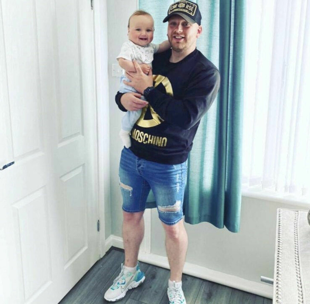 Pappa Kieren tog bilder av svullnaden – för att varna läkarna.