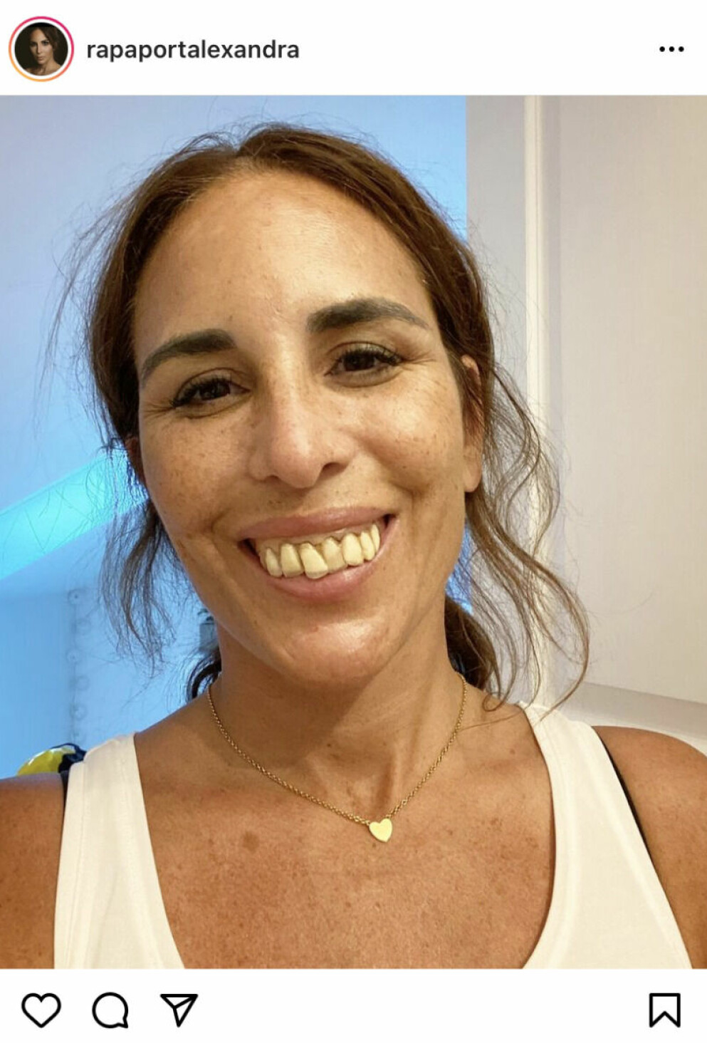 Alexandra Rapaport i karaktären Sonja med löständer. Alexandra Rapaport med fake-tänder