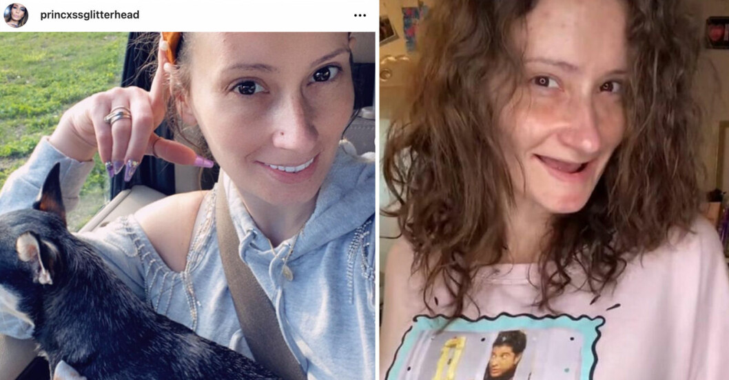 <strong>För varje graviditet blev Alicias tänder sämre och sämre. </strong> Alicia fick sämre och sämre tänder för varje graviditet.