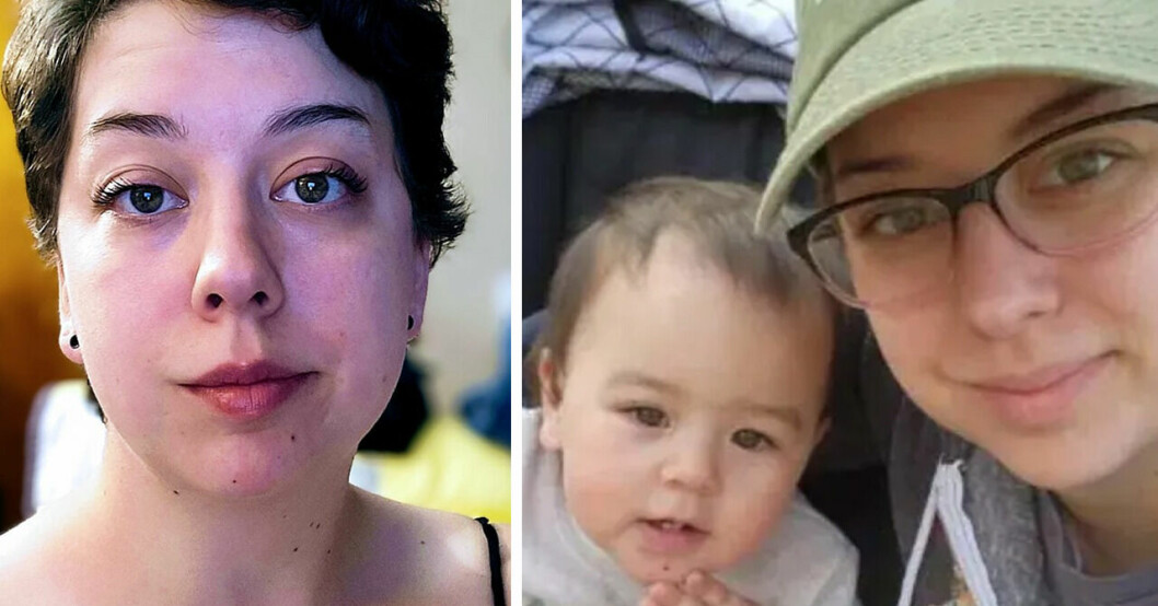 Amanda hade huvudvärk i fem dagar – fick stroke som 32-åring.