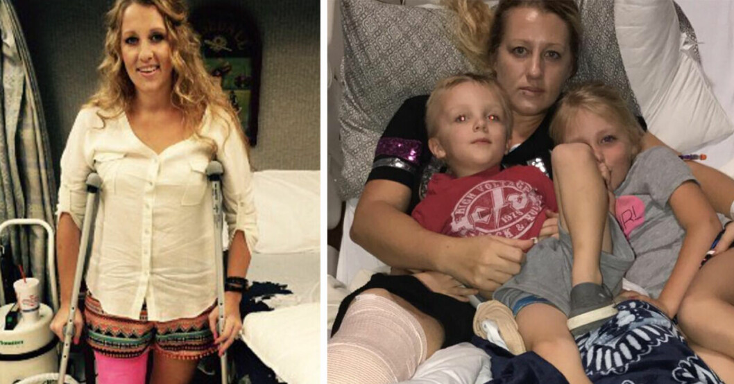 Angie, 41, lekte i snön med barnen – fick amputera benet efter olyckan.