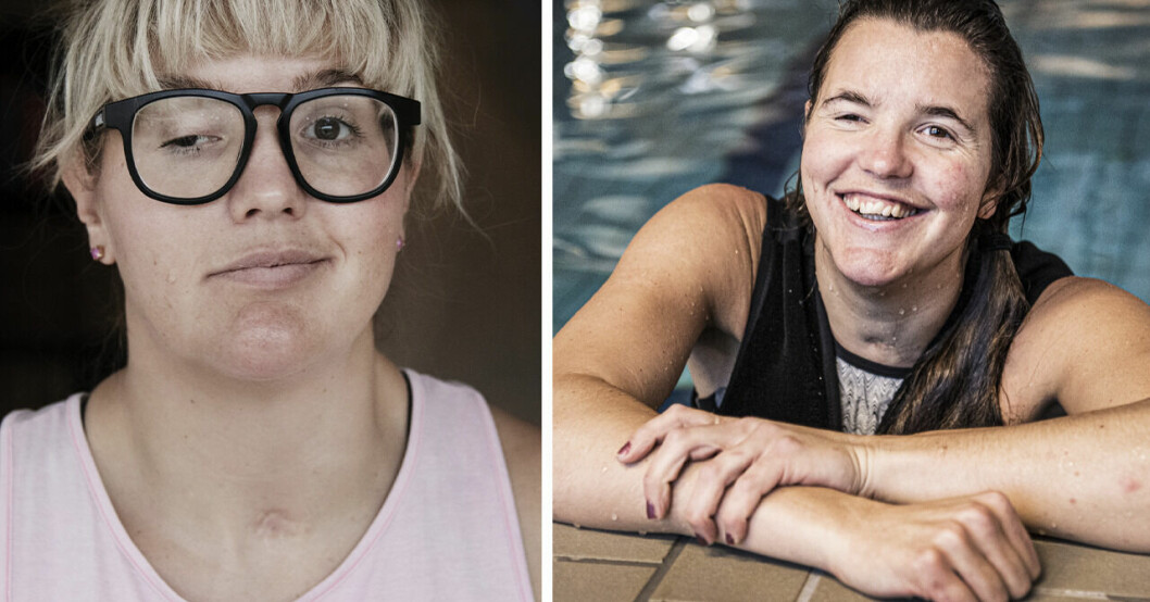 Anna Holmlunds ärliga ord om hjärnskadan: ”Det jobbigaste är...”