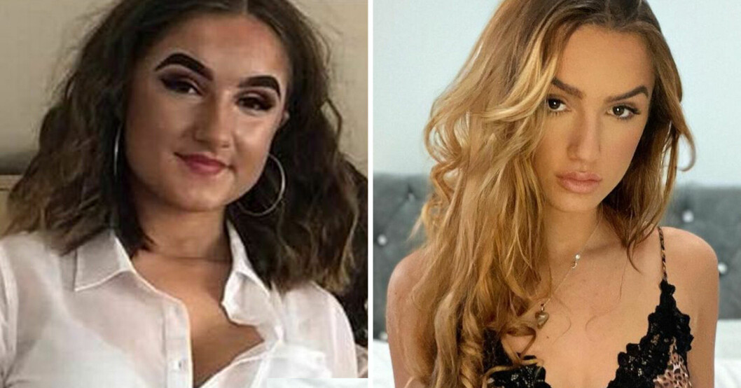 April Opal mobbades för att hon var ful i tonåren – nu tjänar hon miljoner på sitt utseende