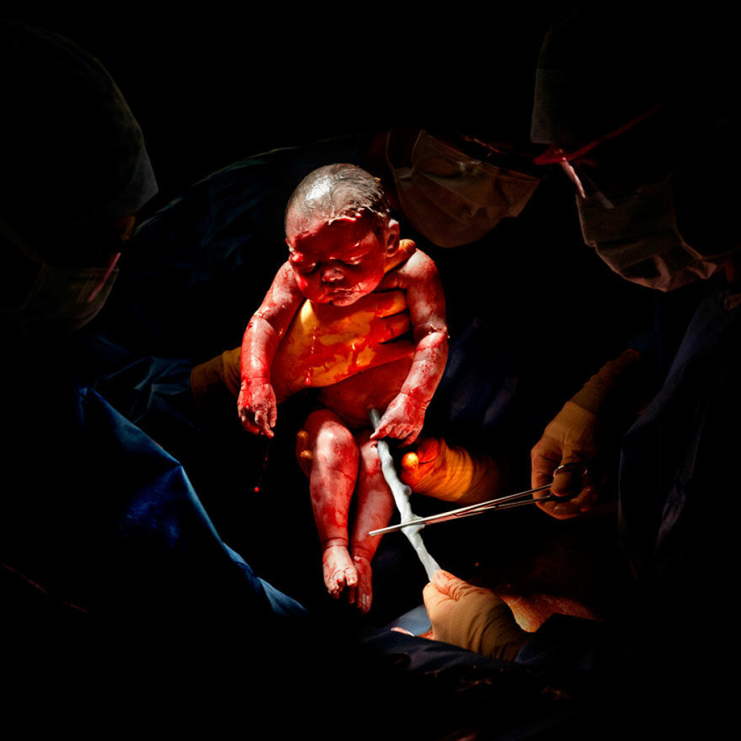 Foto: <a href="http://home.christianberthelot.com/" target="_blank" rel="noopener">Christian Berthelot</a> baby2
