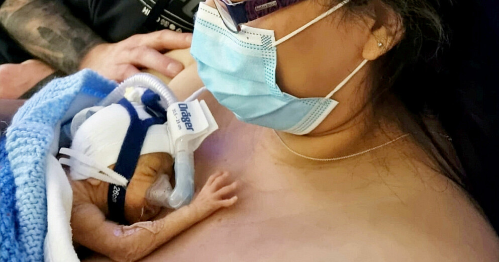 Det tog flera veckor innan Pace var tillräckligt stark för att ligga i mamma Bellas famn. Pace Galbraith med mamma Bella