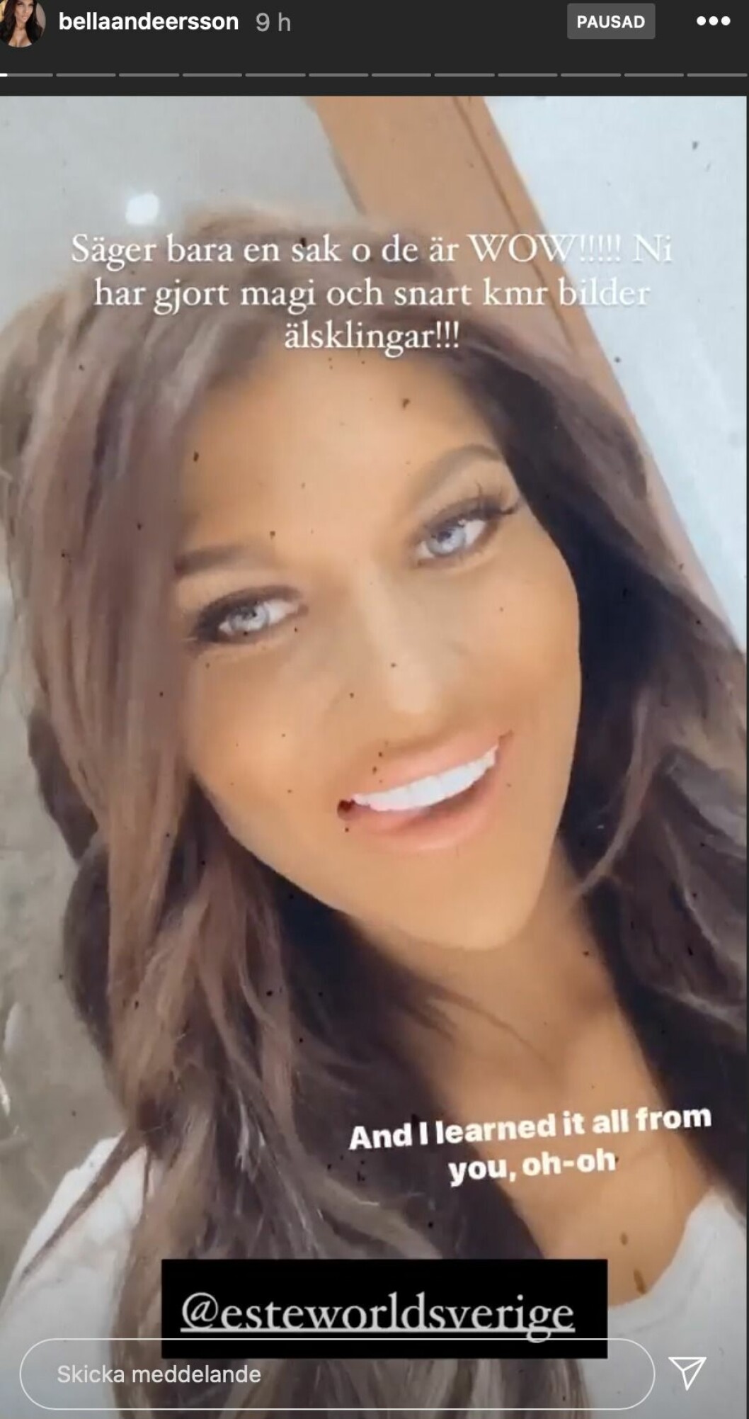 FOTO: Instagram Bella Andersson visar upp nya tänderna