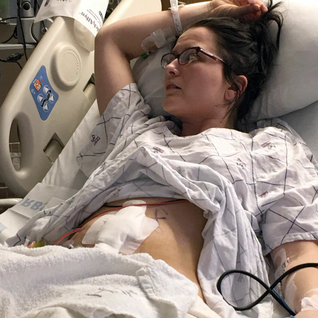 Chelsea Jovanovich, 33, efter sin transplantation – då hon fick en fungerande en livmoder av en okänd donator.