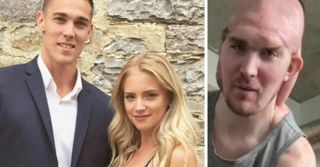 Ben från Kanada misshandlades i London – låg kvar på sjukhuset i fyra år.