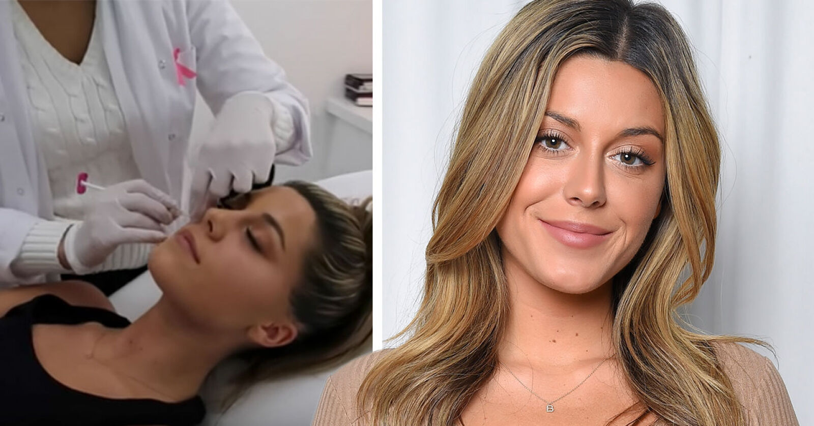 Bianca Ingrosso Avsl jar Sanningen Om Nya Sk nhetsingreppet H nt bianca-ingrosso-avsl-jar-sanningen-om-nya-sk-nhetsingreppet-h-nt