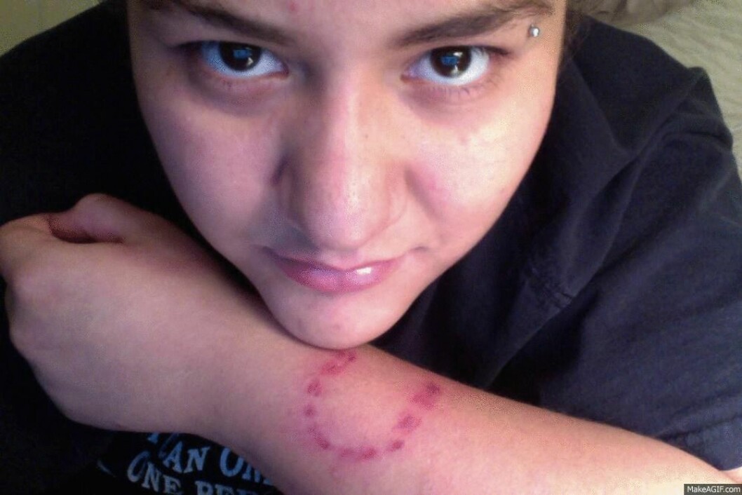 Via: <a href="http://makeagif.com/" target="_blank" rel="noopener">Make a gif</a> bite herself
