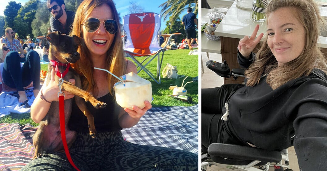 Brooke Eby innan och efter diagnosen.