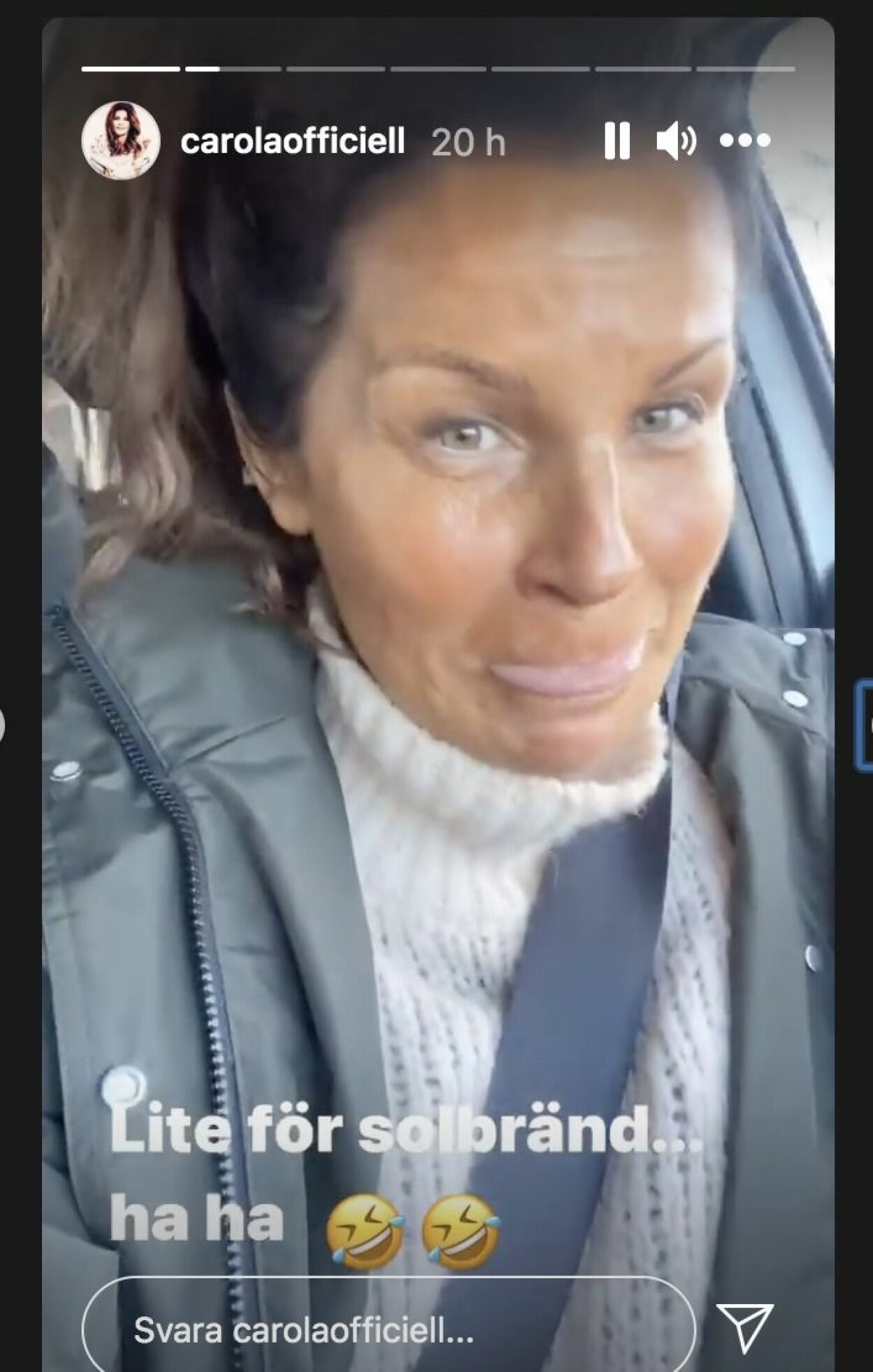 Carola visar upp plötsliga utseendeförändringen. Carola Häggkvist