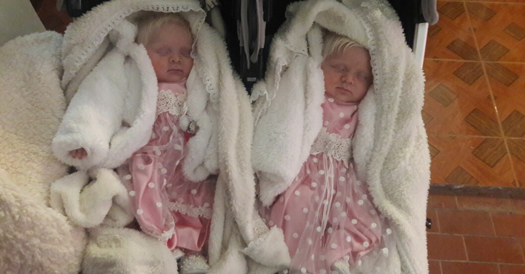 För fyra år sedan skrev tvillingarna Catalina och Virginia historia. De föddes båda med albinism – något som aldrig hänt i Argentina. Catalina och Virginia