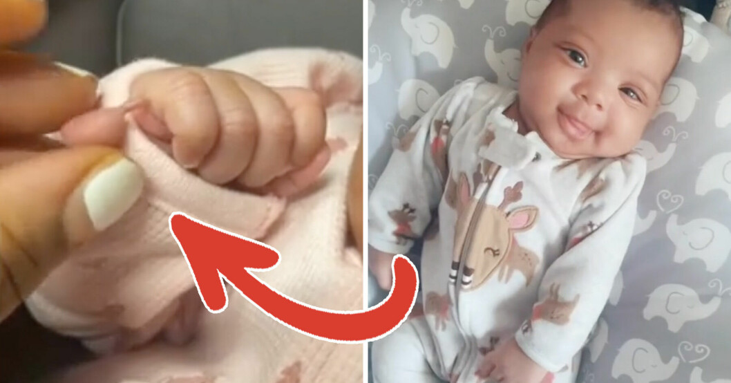Mamma Talliya son föddes med ett extra finger.