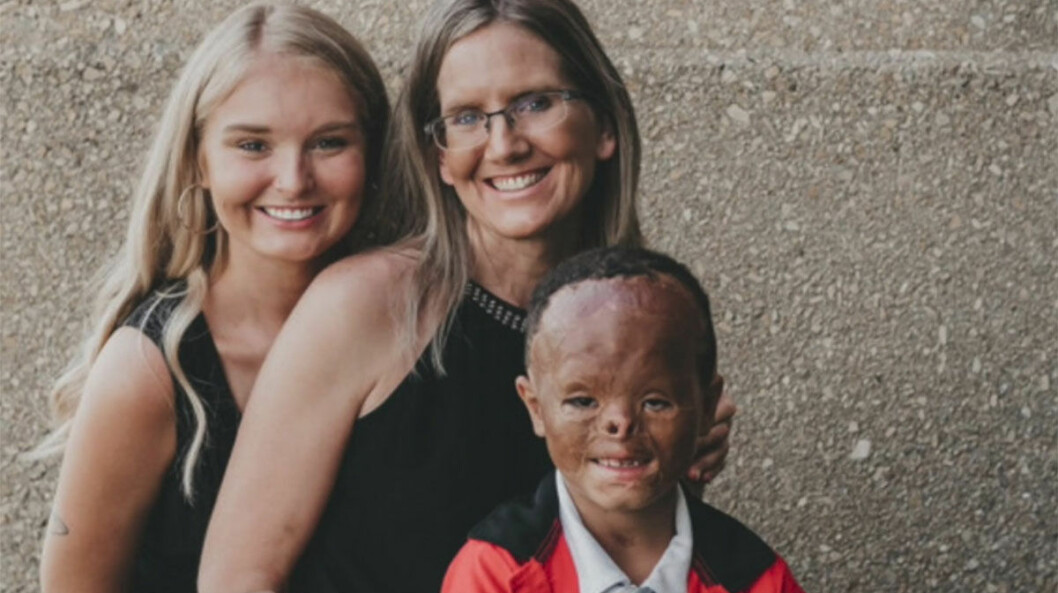 Mamma Beth hittade tillslut den brännskadade pojken – och adopterade honom.