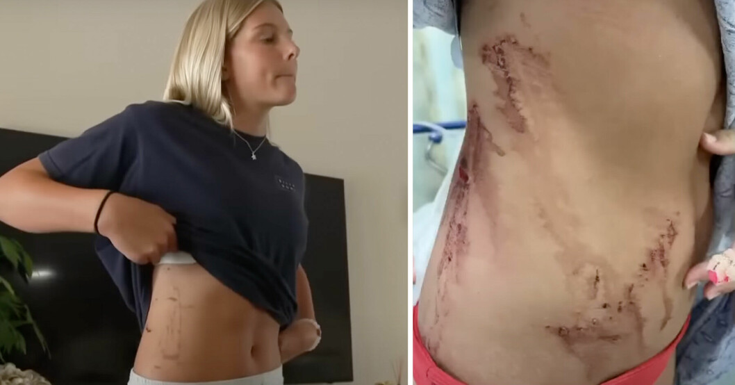 Ella, 13, blev brutalt attackerad i vattnet.
