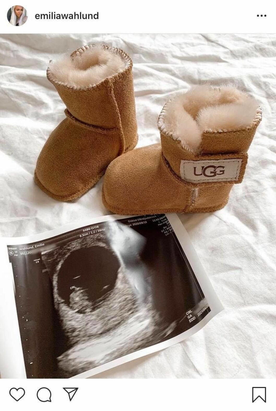 FOTO: Instagram Emilia Wahlund avslöjar graviditeten på Instagram