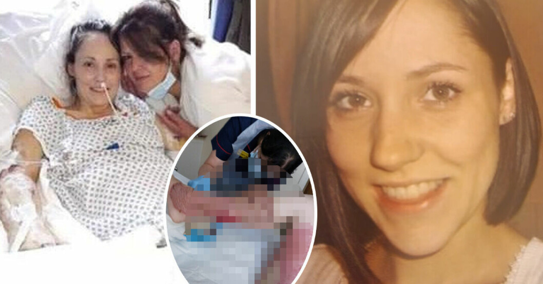 Emma, 37, hade köttätande bakterie – fick 1 procent chans att leva.