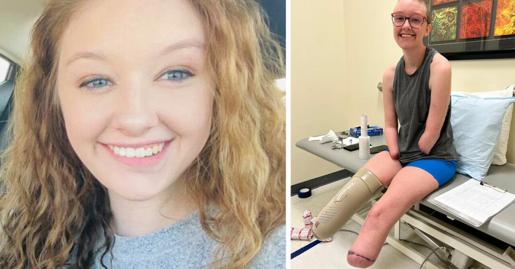 Evelyn, 22, blev sjuk efter konserten – fick amputera armar och ben.