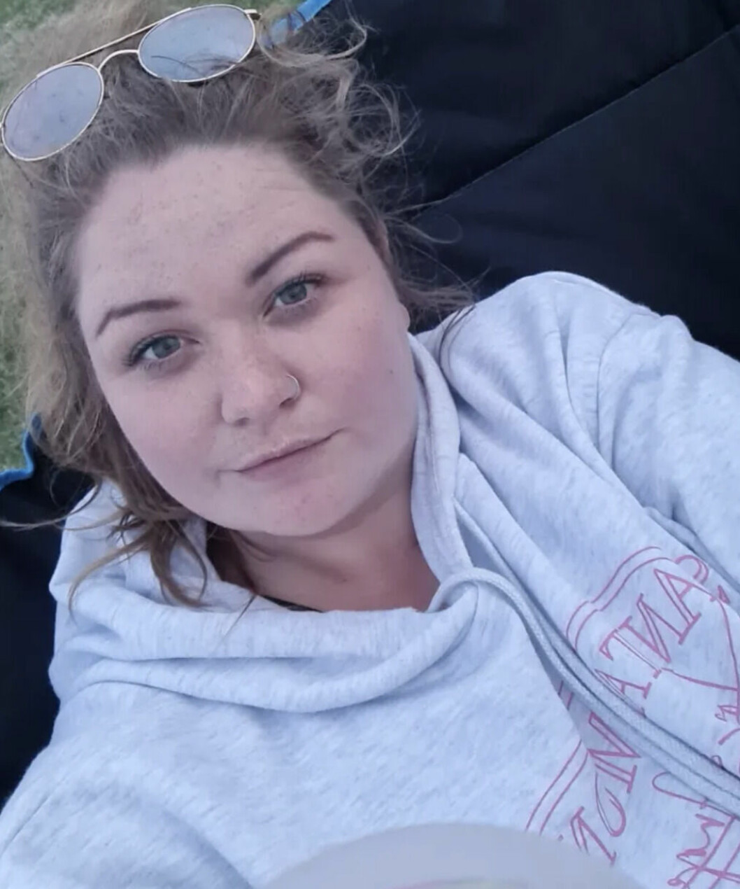 Chloe Barnard, 29, lider av extremt ovanliga minnesförluster.