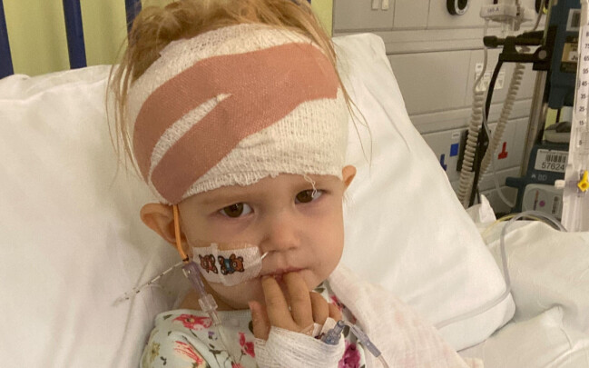 Orla var bara 20 månader gammal när läkarna identifierade hennes hjärncancer. Orla på sjukhuset med bandage runt huvudet.