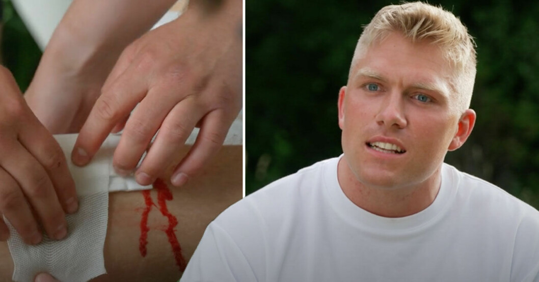 Niklas inledde Farmen med att hugga sig själv med en yxa.