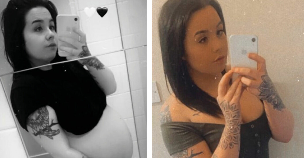 28-åriga Amy blev gravid trots p-piller – då kom STORA chocken