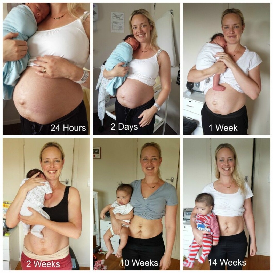 Julie Bhosales kropp och hur den förändrades – 24 timmar efter födseln och 14 veckor senare. Via: <a href="http://juliebhosale.co.nz/my-real-postpartum-body/" target="_blank">Juliebhosale.com</a> Final