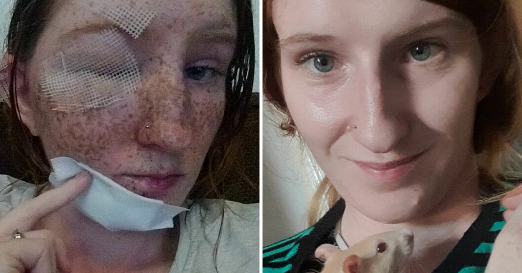 Charlotte Fosters fräknar smälte bort i attacken.
