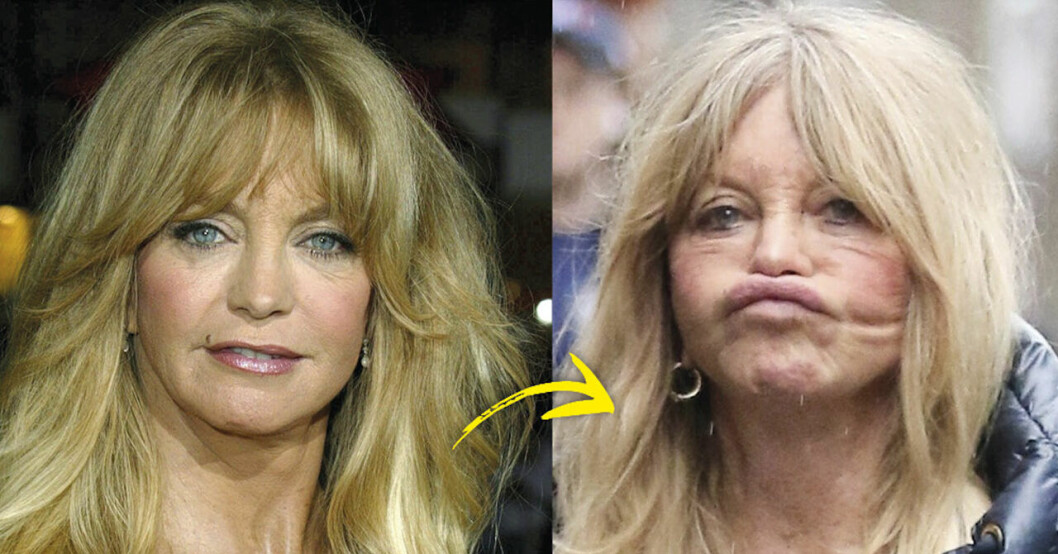Goldie Hawn