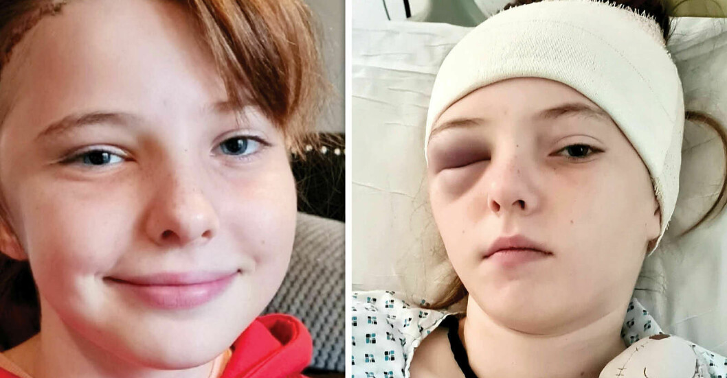 Grace Kelly gick på en rutinkontroll till sin optiker – hittade en enorm tumör bakom hennes ögon.