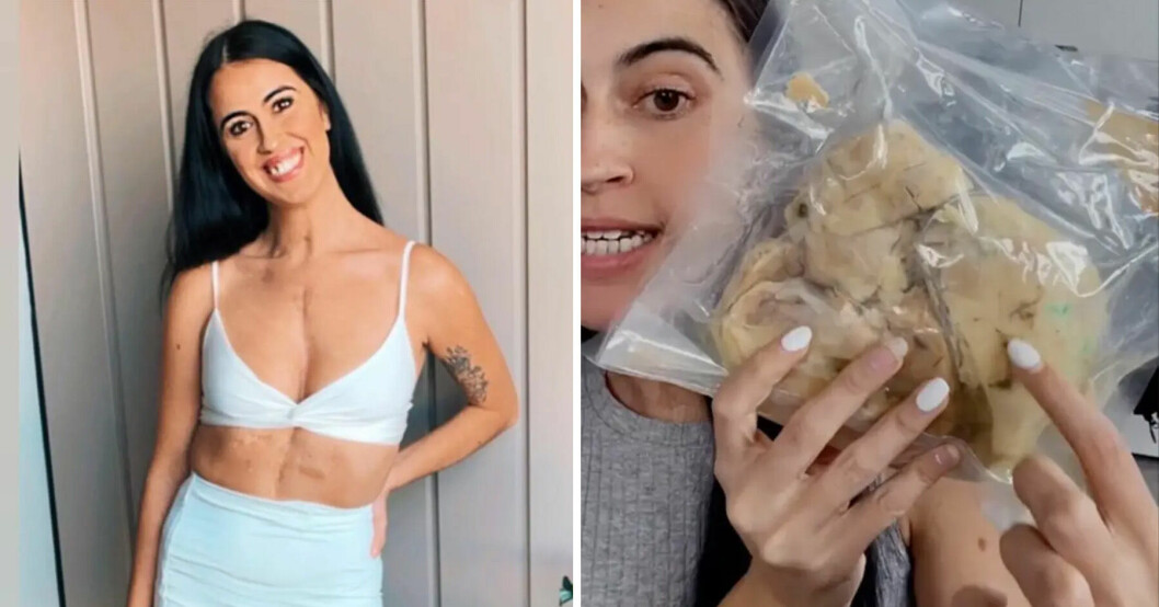 Jessica, 29, förvarar sitt hjärta i en plastpåse.