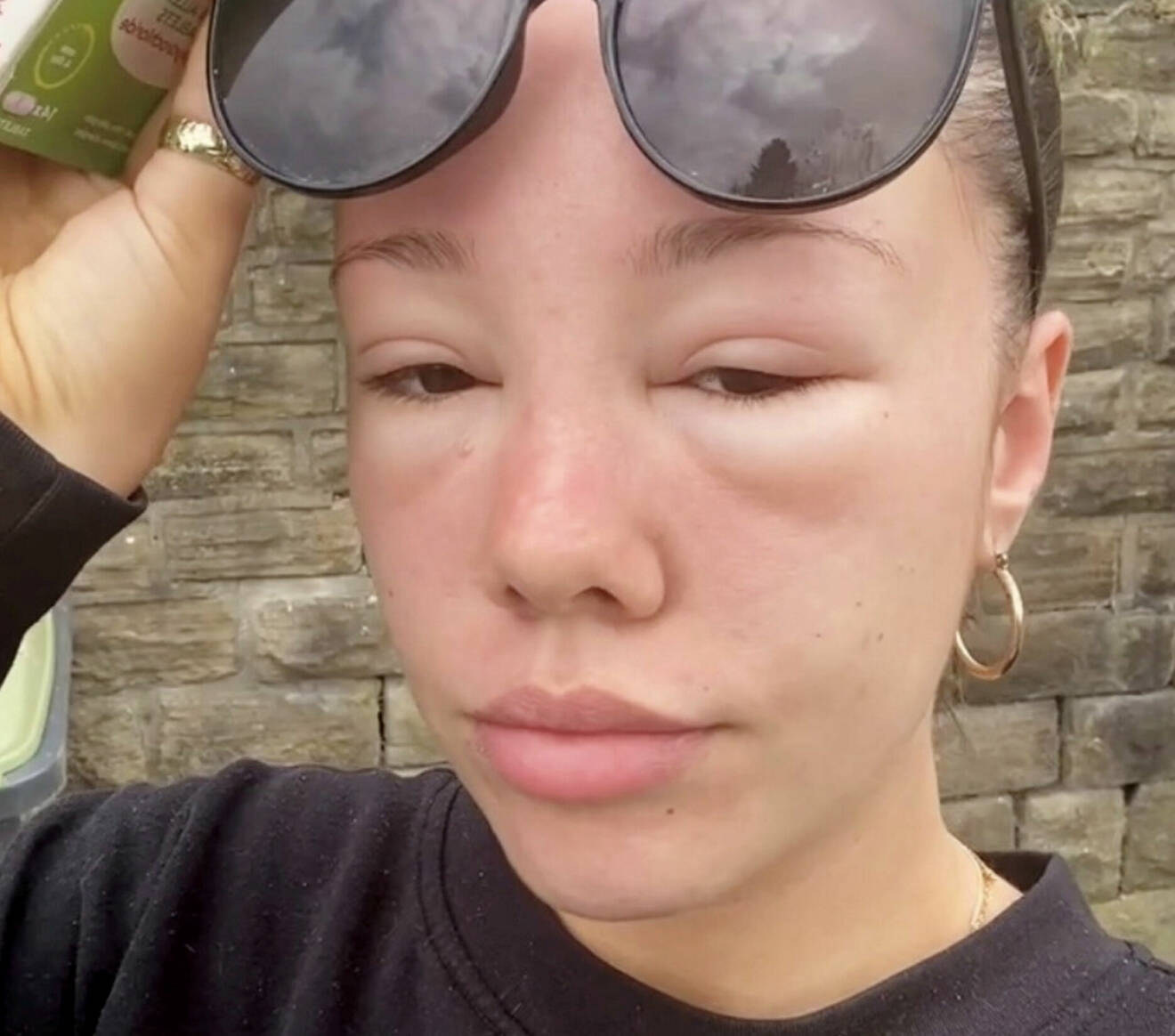 Orla, 22, tvingades ha solglasögonen på när hon kom hem.