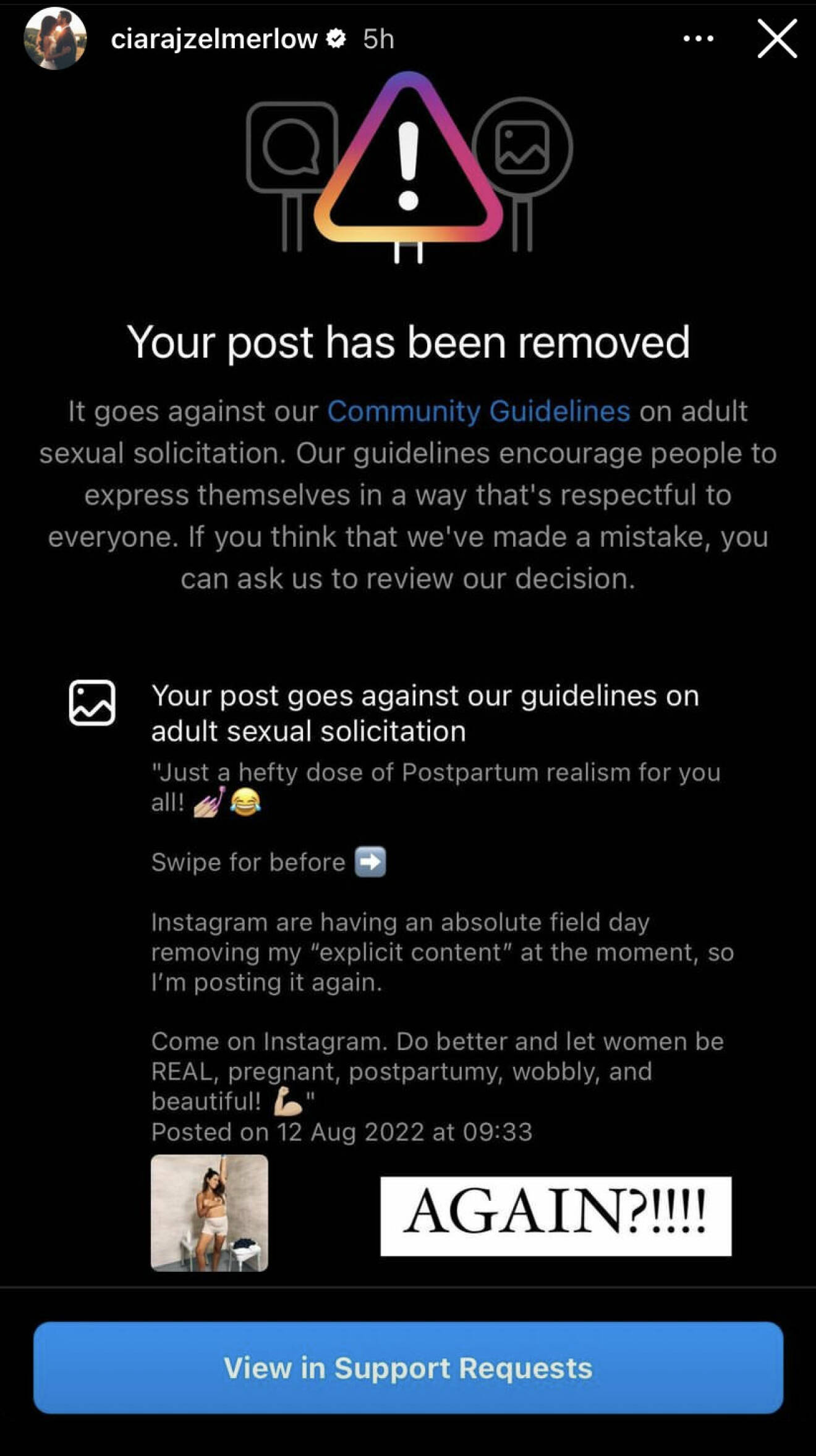 I en Instagram story påvisar Ciara hur Instagram censurerat hennes bilder.