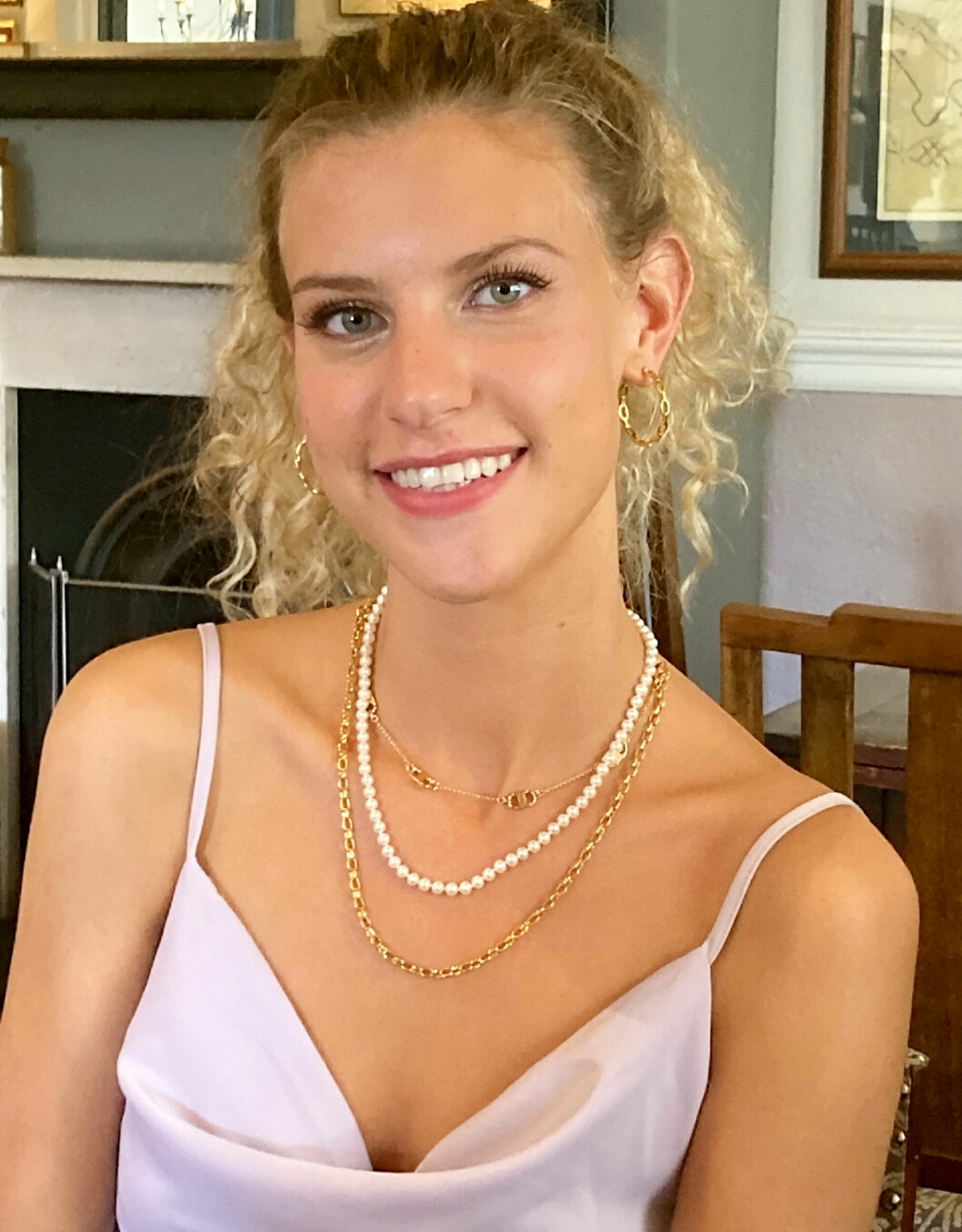 Helena Smythe, 23, lider av en extremt ovanlig sjukdom.