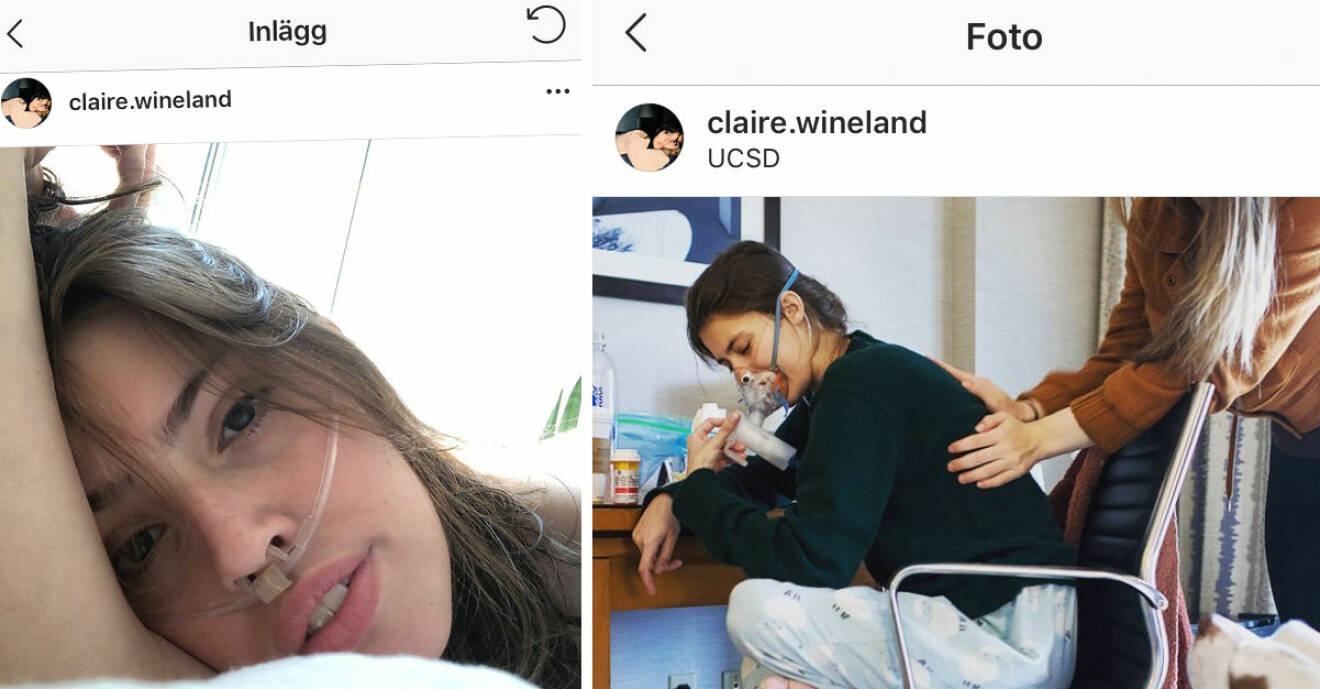 Youtube-stjärnan Claire Wineland har dött efter en stroke till följd av en lungtransplantation.