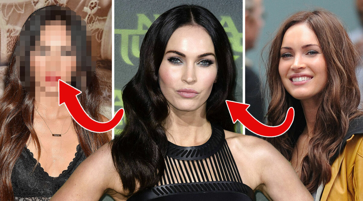 Läkarna avslöjar: Det ligger bakom Megan Fox stora förvandling | Hänt