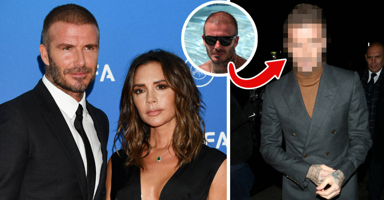 Det ryktas om att David Beckham gjort en hårtranplantation efter att han synts med en betydligt tjockare kalufs.