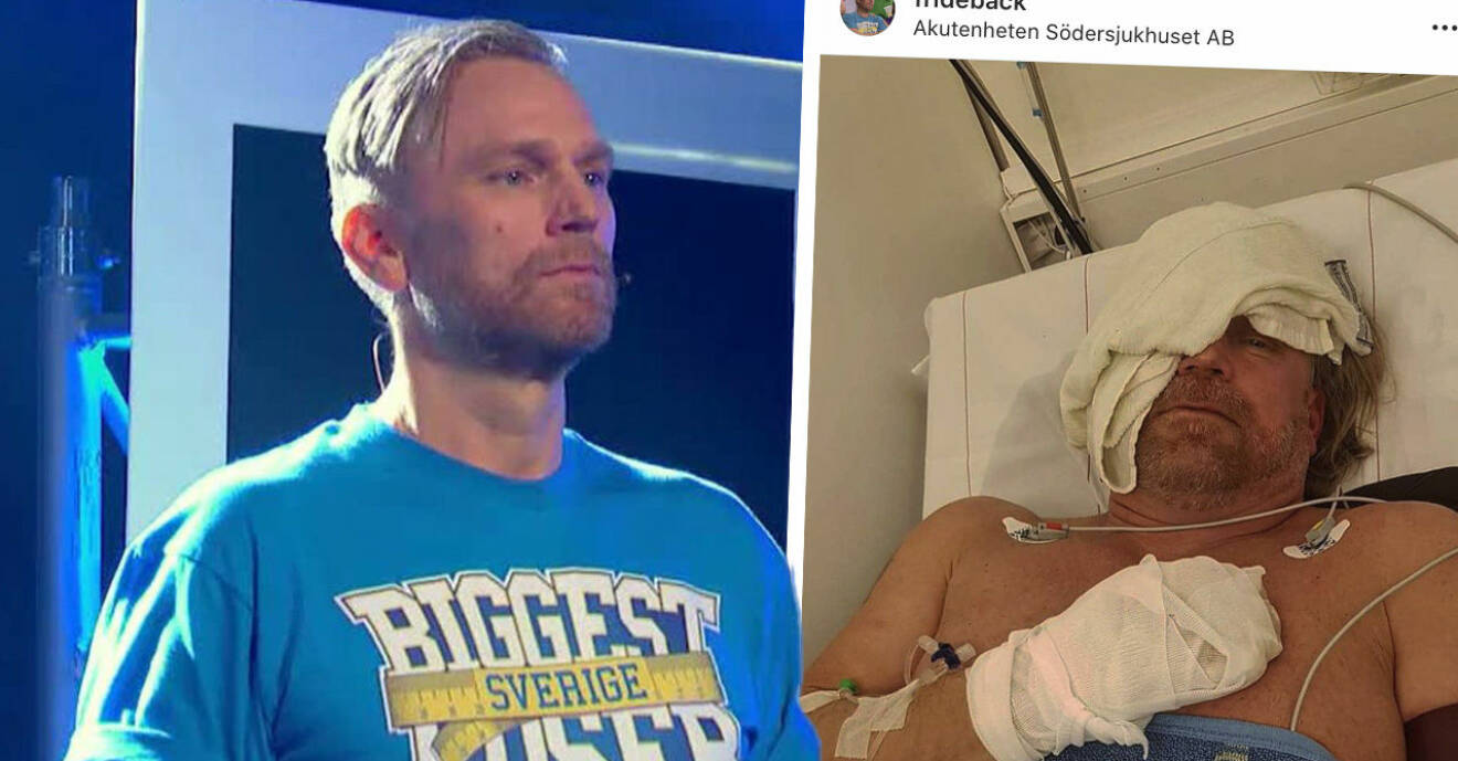 Biggest loser-profilen Michael Fridebäck lades akut in på sjukhus efter att ha börjat brinna.