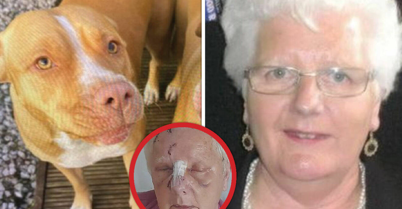 Jacqueline McGrew, 75, attackerades av blodtörstig hund.