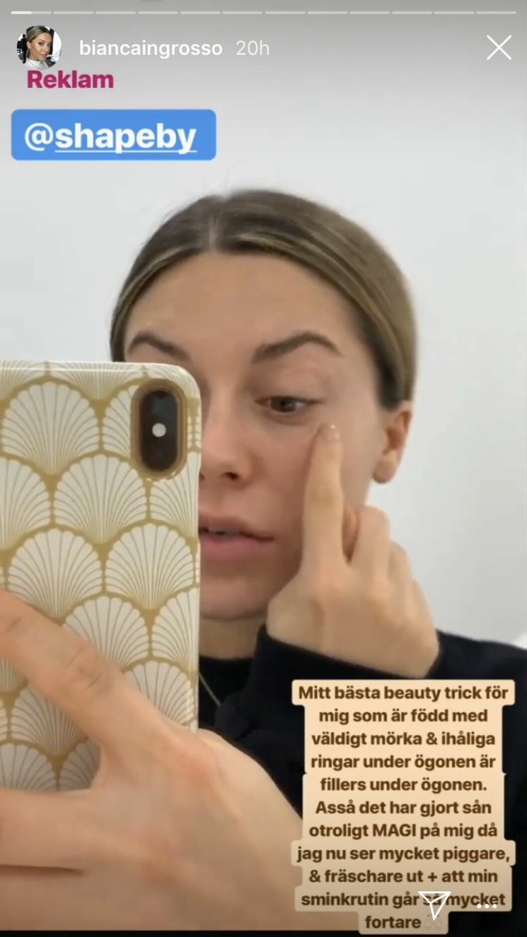 Bianca Ingrosso visar upp det senaste skönhetsingreppet. Bianca Ingrossos senaste skönhetsingrepp