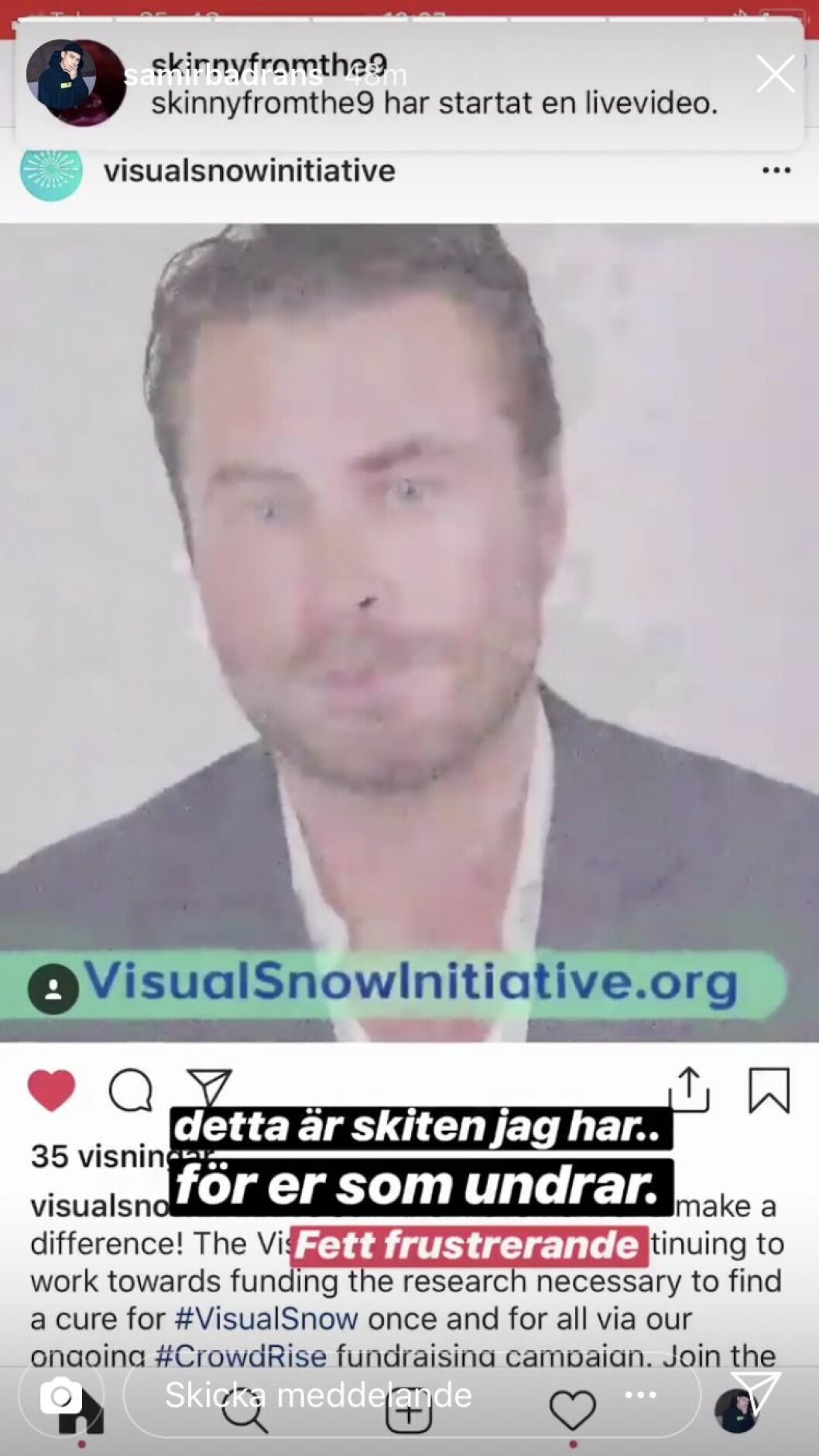 Samir har tidigare publicerat denna bild som illustrerar hur dåligt han ser. Samir Badran bild om visual snow