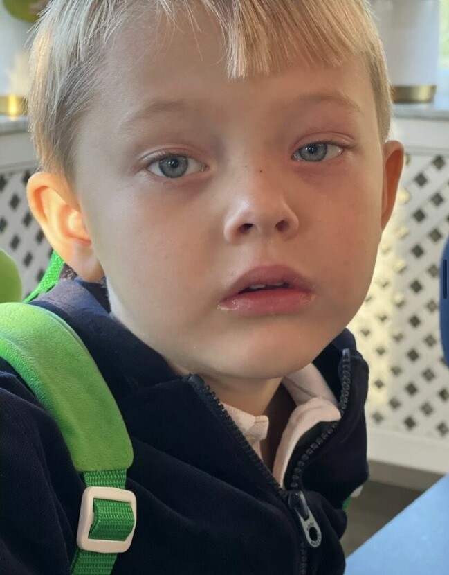 Lite hängigt öga.. men sååå mycket bättre idag, skriver Perrelli under bilden på Alvin i närbild. Alvin med lite svullet och hängigt öga på grund av ögoninflammation.