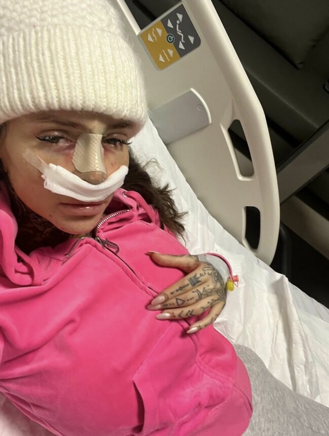 Efter operationen – privat bild