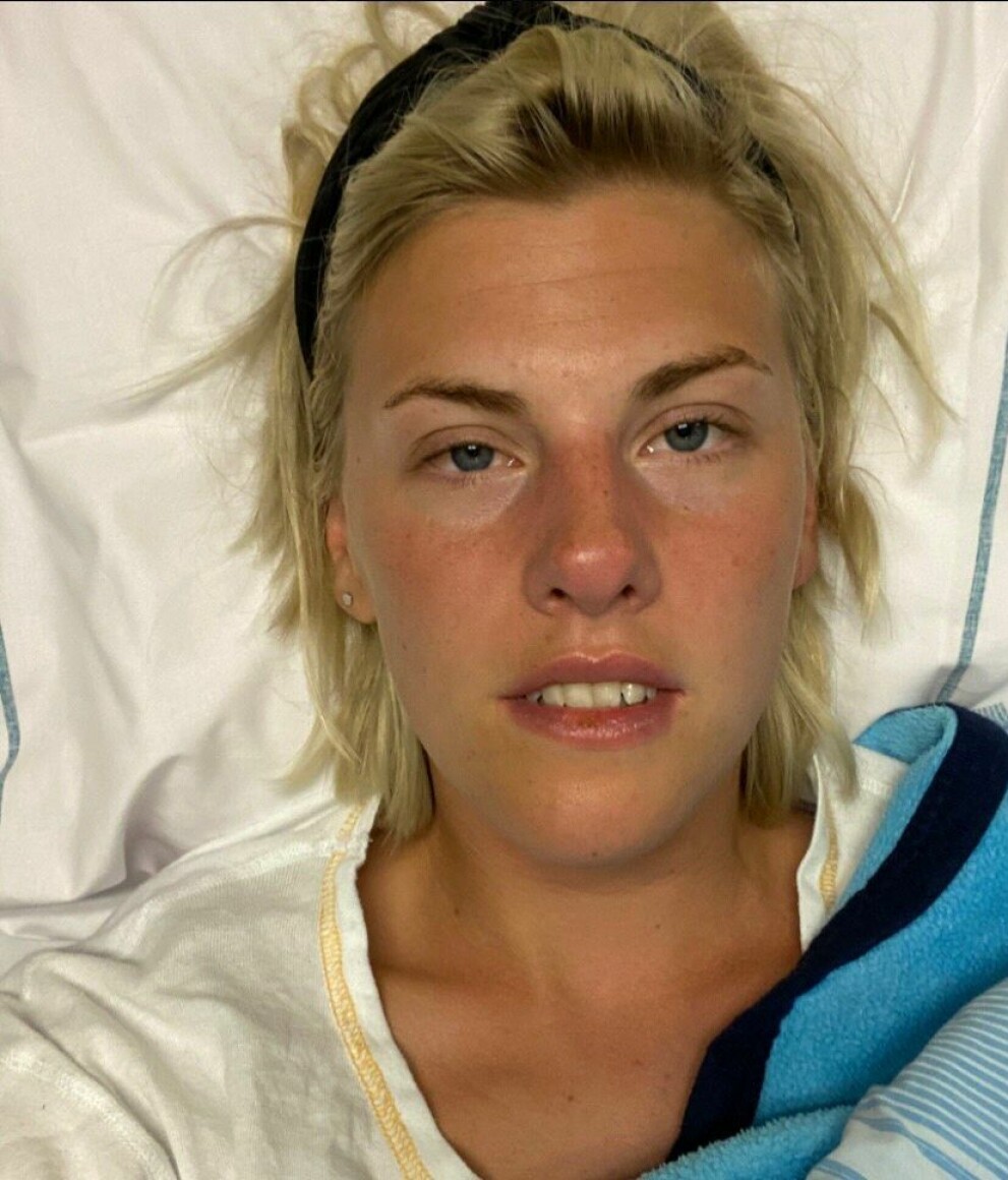 Lovisa kunde ta en selfie när hon var på sjukhuset. Lovisa Almén