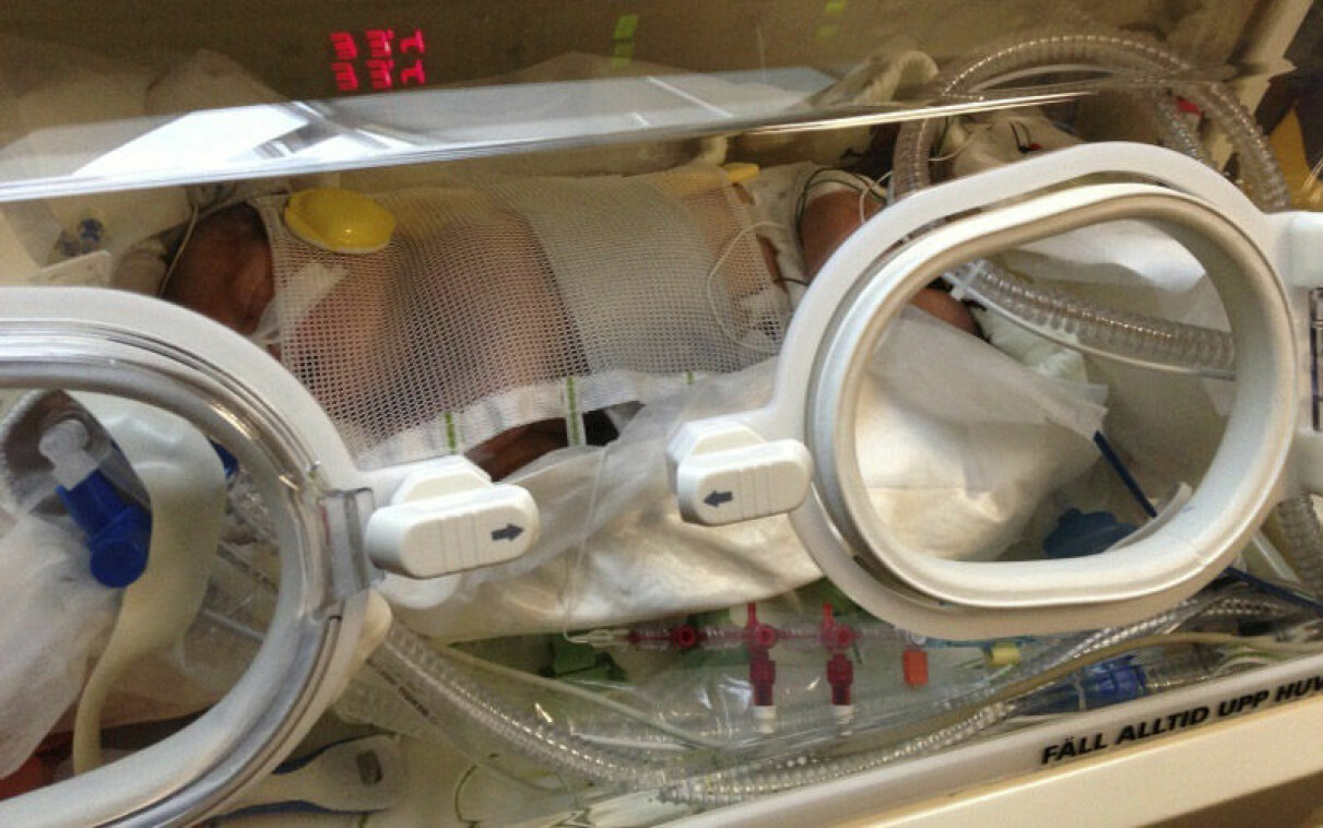 Izabel i respirator på Huddinge sjukhus.