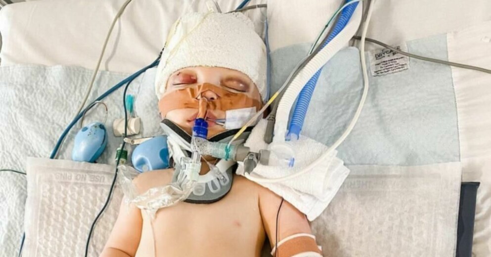 Jaxon fick en skallfraktur, hjärnblödning och ett avslitet nackligament efter olyckan. ”Inget hade kunnat förbereda mig på synen”, säger hans mammam Zoe ten Broek till 7News. Jaxon